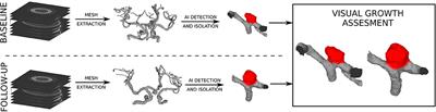 Deep Shape Features for Predicting Future Intracranial Aneurysm Growth